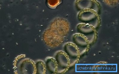 Una goccia sotto il microscopio: la foto mostra le alghe e i microrganismi semplici Una goccia sotto il microscopio: la foto mostra le alghe e i microrganismi semplici