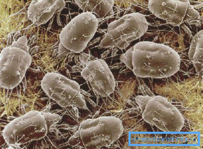 Sulla foto - microrganismi nascosti in una piccola quantità di polvere.